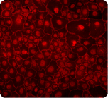 此時(shí)此刻，熒光顯微鏡成為病毒研究的一大法寶