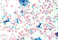 Һ����Ƭ�@΢�DƬ